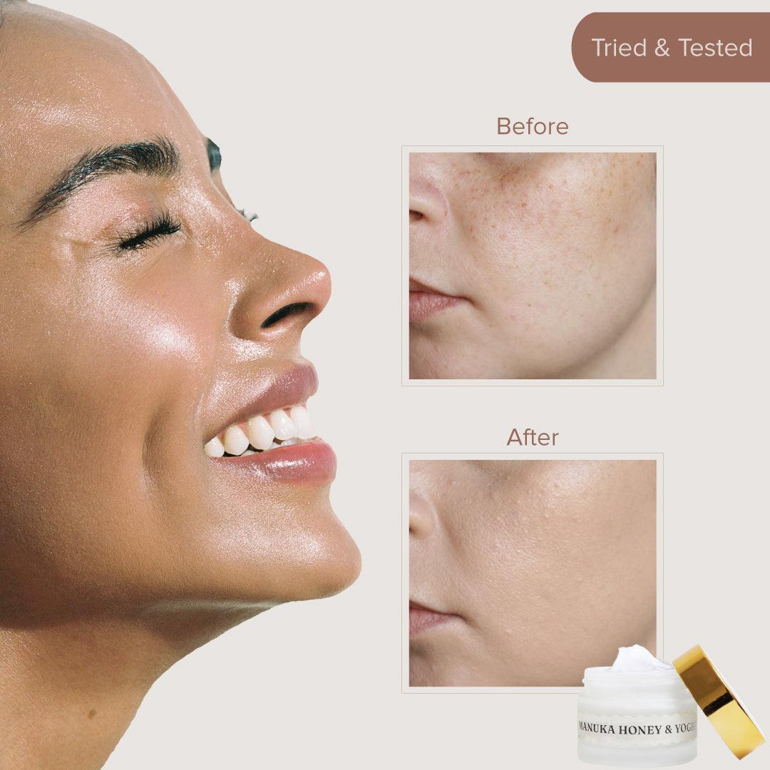 Manuka Honey and Yoghurt Moisturizer Best Face Moisturizer for All Sk