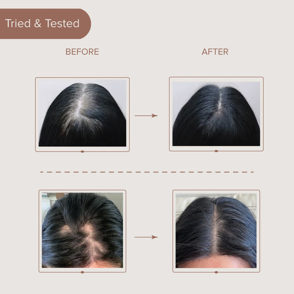 best hair oil for hair growth
