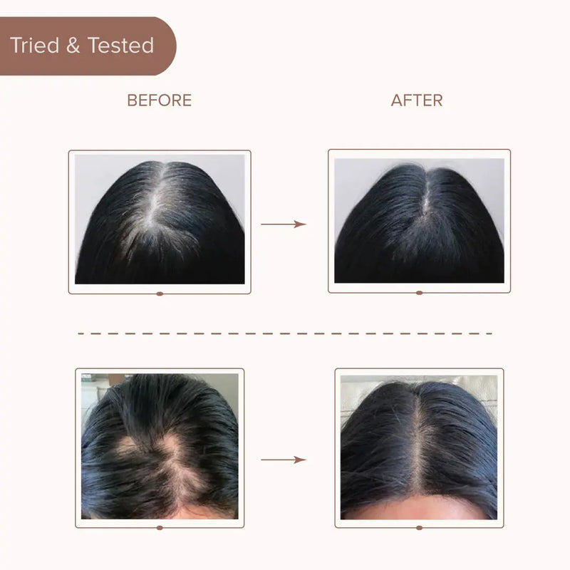 Ayurvedic Hair Brew Oil Dromen & Co