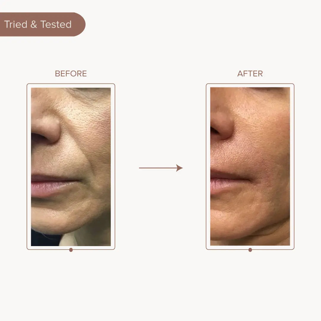Buy Best Under Eye Strips for Dark Circles & Cheek Lines | Dromen & Co.