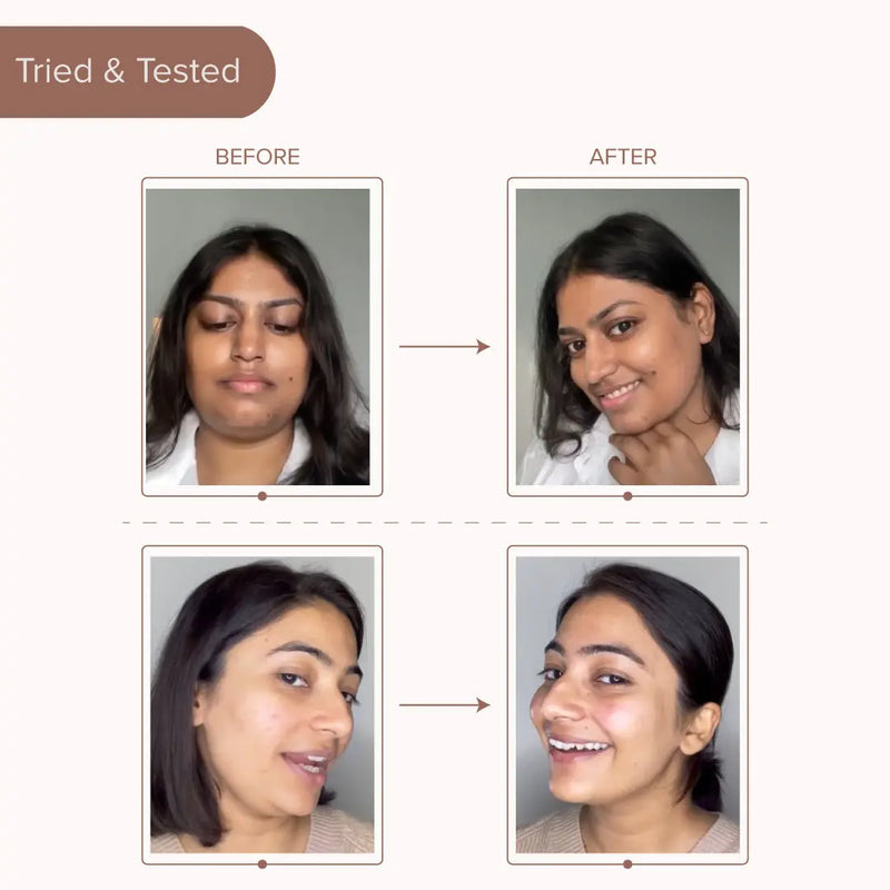 Rose Collagen Chin Mask Dromen & Co